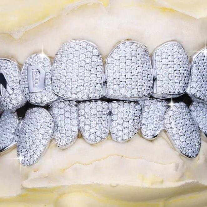 10-on-10 VVS Moissanite Grillz Set in S925 Sterling Silver - Image 3